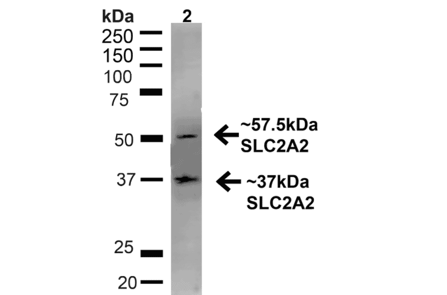 Western Blot - Anti-GLUT2 Antibody (A305171) - Antibodies.com