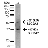 Western Blot - Anti-GLUT2 Antibody (A305171) - Antibodies.com
