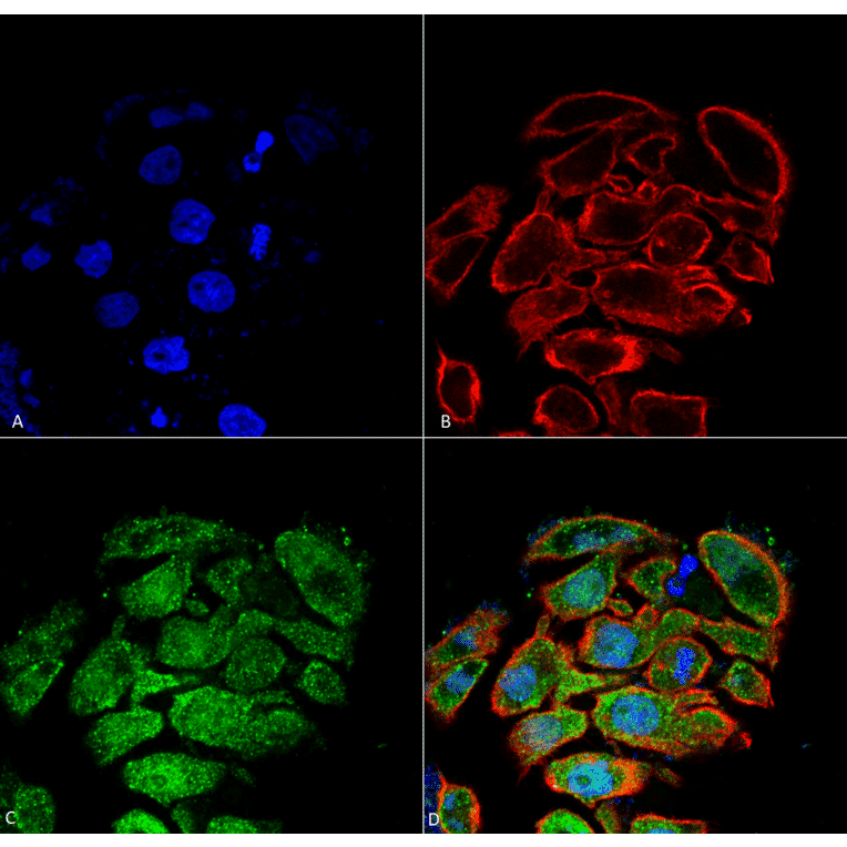 Immunocytochemistry/Immunofluorescence - Anti-GLUT2 Antibody (A305171) - Antibodies.com
