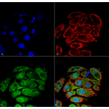 Immunocytochemistry/Immunofluorescence - Anti-GLUT2 Antibody (A305171) - Antibodies.com