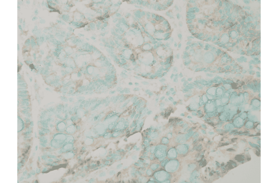 Immunohistochemistry - Anti-PUMA Antibody (A305172) - Antibodies.com