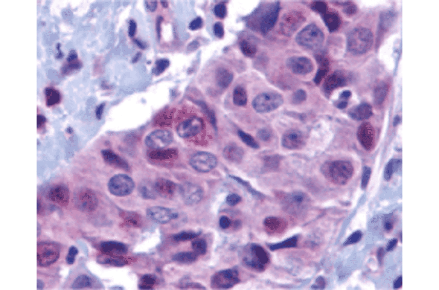 Immunohistochemistry - Anti-PUMA Antibody (A305172) - Antibodies.com