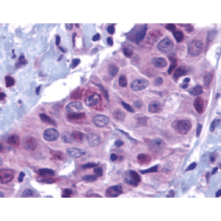 Immunohistochemistry - Anti-PUMA Antibody (A305172) - Antibodies.com