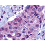 Immunohistochemistry - Anti-PUMA Antibody (A305172) - Antibodies.com