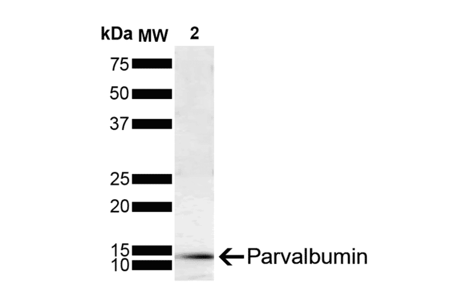 Western Blot - Anti-Parvalbumin Antibody [C12] (A305173) - Antibodies.com