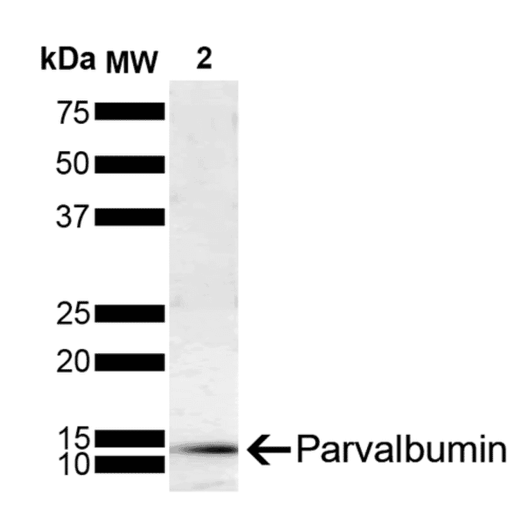 Western Blot - Anti-Parvalbumin Antibody [C12] (A305173) - Antibodies.com