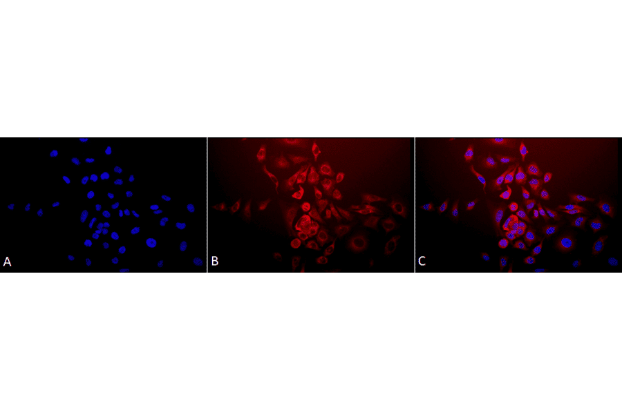 Immunocytochemistry/Immunofluorescence - Anti-SOD2 / MnSOD Antibody (A305174) - Antibodies.com