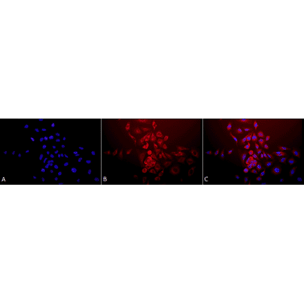 Immunocytochemistry/Immunofluorescence - Anti-SOD2 / MnSOD Antibody (A305174) - Antibodies.com