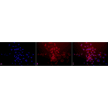 Immunocytochemistry/Immunofluorescence - Anti-SOD2 / MnSOD Antibody (A305174) - Antibodies.com