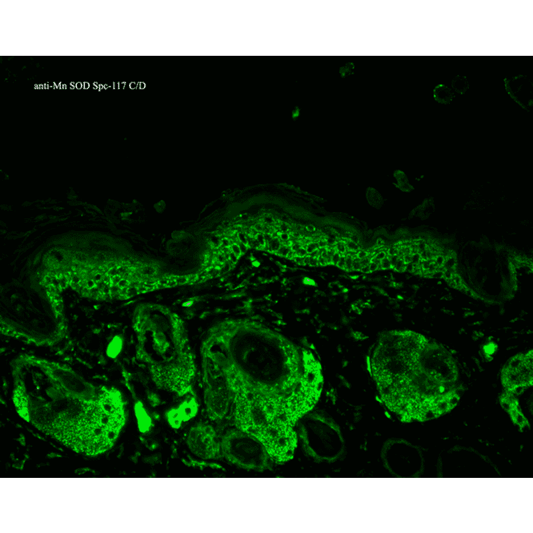 Immunohistochemistry - Anti-SOD2 / MnSOD Antibody (A305174) - Antibodies.com