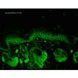 Immunohistochemistry - Anti-SOD2 / MnSOD Antibody (A305174) - Antibodies.com