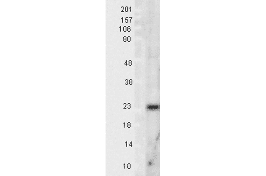 Western Blot - Anti-SOD2 / MnSOD Antibody (A305174) - Antibodies.com