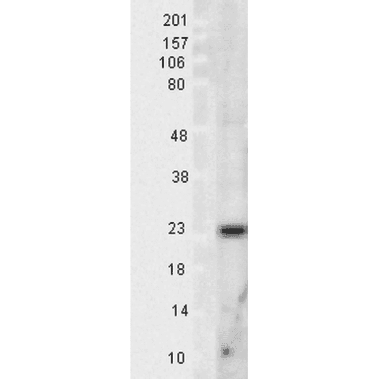 Western Blot - Anti-SOD2 / MnSOD Antibody (A305174) - Antibodies.com