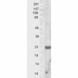 Western Blot - Anti-SOD2 / MnSOD Antibody (A305174) - Antibodies.com