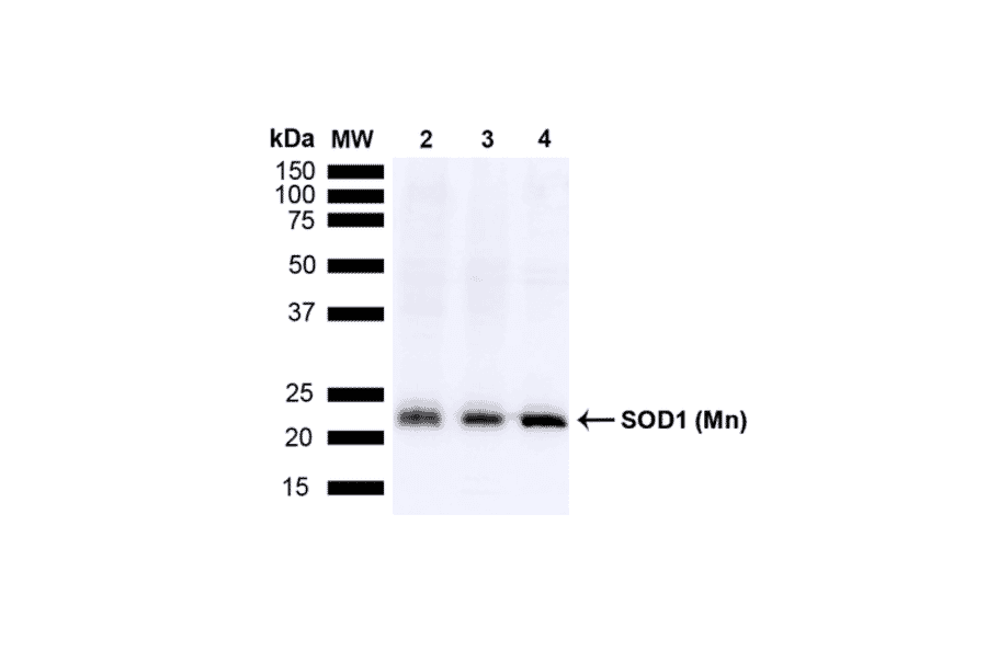 Western Blot - Anti-SOD2 / MnSOD Antibody (A305175) - Antibodies.com