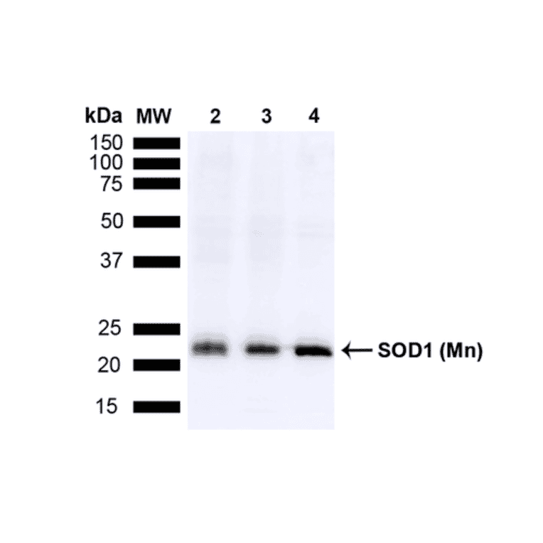 Western Blot - Anti-SOD2 / MnSOD Antibody (A305175) - Antibodies.com