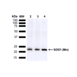 Western Blot - Anti-SOD2 / MnSOD Antibody (A305175) - Antibodies.com