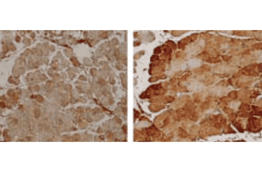 Immunohistochemistry - Anti-SOD2 / MnSOD Antibody (A305175) - Antibodies.com