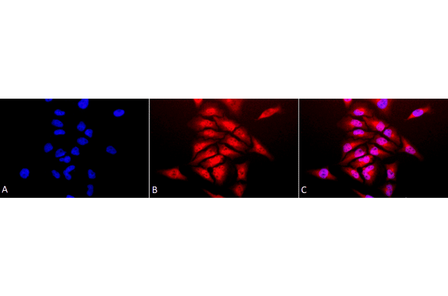 Immunocytochemistry/Immunofluorescence - Anti-Superoxide Dismutase 1 Antibody (A305176) - Antibodies.com