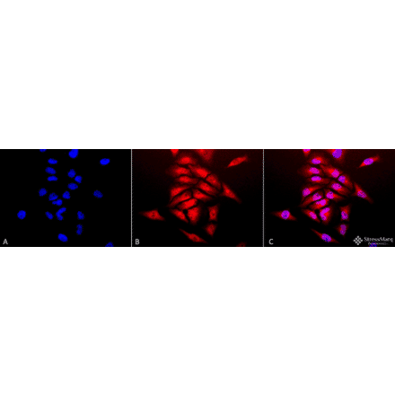 Immunocytochemistry/Immunofluorescence - Anti-Superoxide Dismutase 1 Antibody (A305176) - Antibodies.com