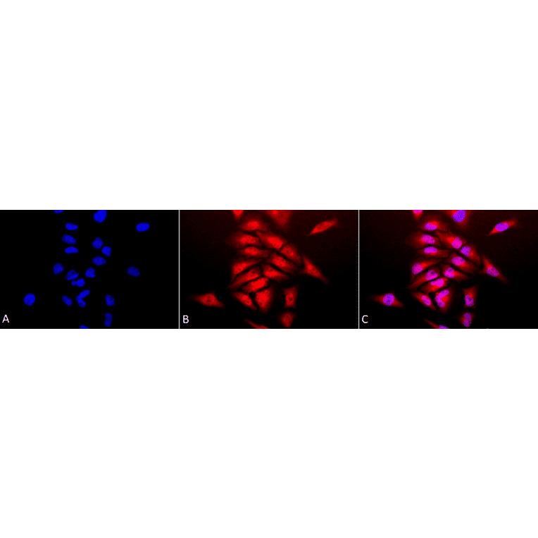 Immunocytochemistry/Immunofluorescence - Anti-Superoxide Dismutase 1 Antibody (A305176) - Antibodies.com