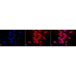 Immunocytochemistry/Immunofluorescence - Anti-Superoxide Dismutase 1 Antibody (A305176) - Antibodies.com