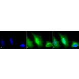 Immunocytochemistry/Immunofluorescence - Anti-Superoxide Dismutase 1 Antibody (A305176) - Antibodies.com