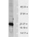 Western Blot - Anti-Superoxide Dismutase 1 Antibody (A305177) - Antibodies.com
