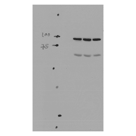 Western Blot - Anti-SCNN1A Antibody (A305178) - Antibodies.com
