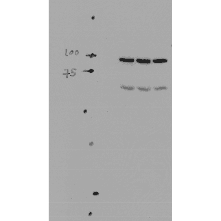 Western Blot - Anti-SCNN1A Antibody (A305178) - Antibodies.com