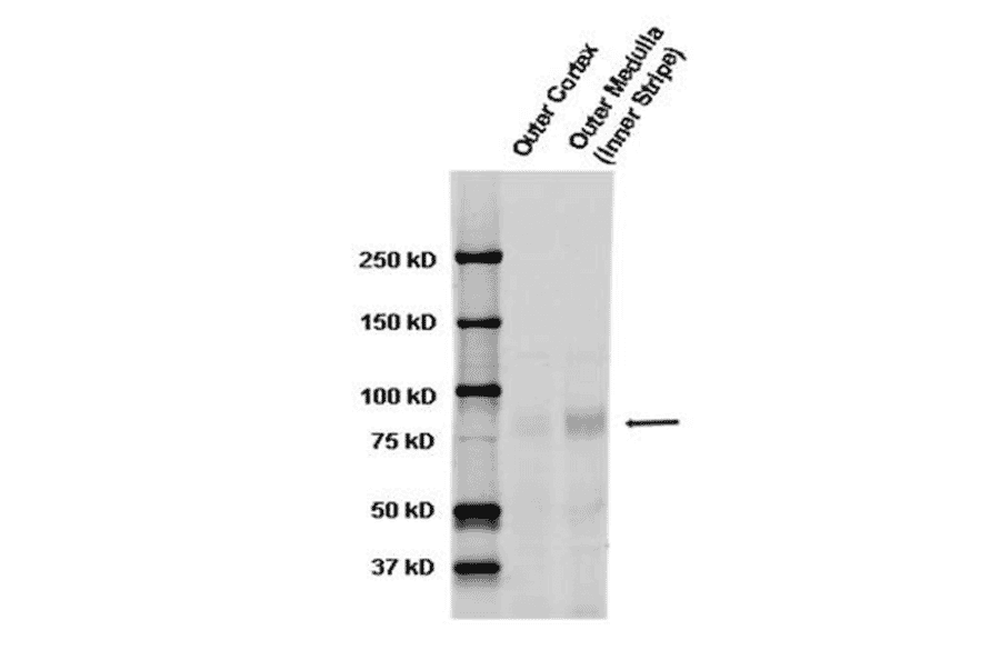 Western Blot - Anti-SCNN1A Antibody (A305178) - Antibodies.com