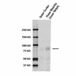 Western Blot - Anti-SCNN1A Antibody (A305178) - Antibodies.com