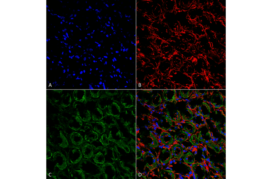 Immunohistochemistry - Anti-SCNN1A Antibody (A305178) - Antibodies.com