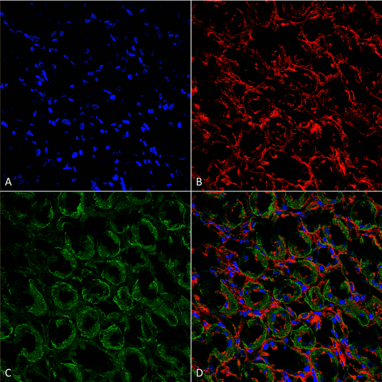 Immunohistochemistry - Anti-SCNN1A Antibody (A305178) - Antibodies.com