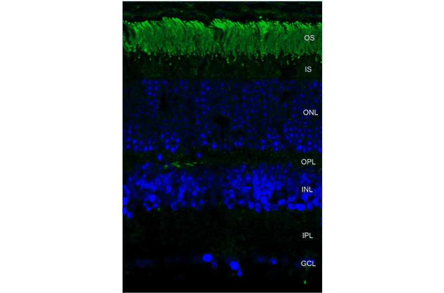 Immunohistochemistry - Anti-Rhodopsin Antibody [4D2] (A305179) - Antibodies.com