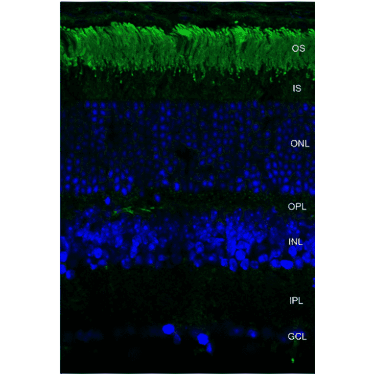 Immunohistochemistry - Anti-Rhodopsin Antibody [4D2] (A305179) - Antibodies.com