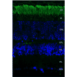 Immunohistochemistry - Anti-Rhodopsin Antibody [4D2] (A305179) - Antibodies.com