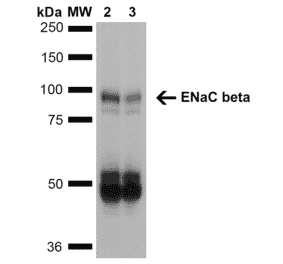 Western Blot - Anti-SCNN1B Antibody [7B8] (A305180) - Antibodies.com