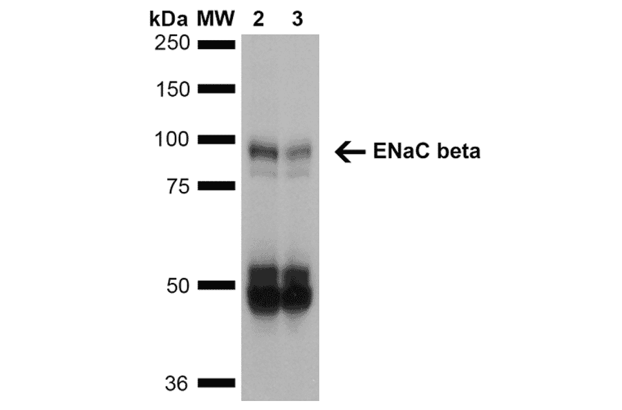 Western Blot - Anti-SCNN1B Antibody [7B8] (A305180) - Antibodies.com
