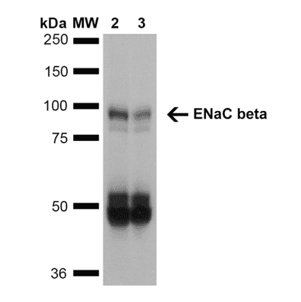 Western Blot - Anti-SCNN1B Antibody [7B8] (A305180) - Antibodies.com