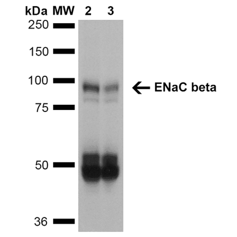 Western Blot - Anti-SCNN1B Antibody [7B8] (A305180) - Antibodies.com