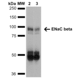 Western Blot - Anti-SCNN1B Antibody [7B8] (A305180) - Antibodies.com