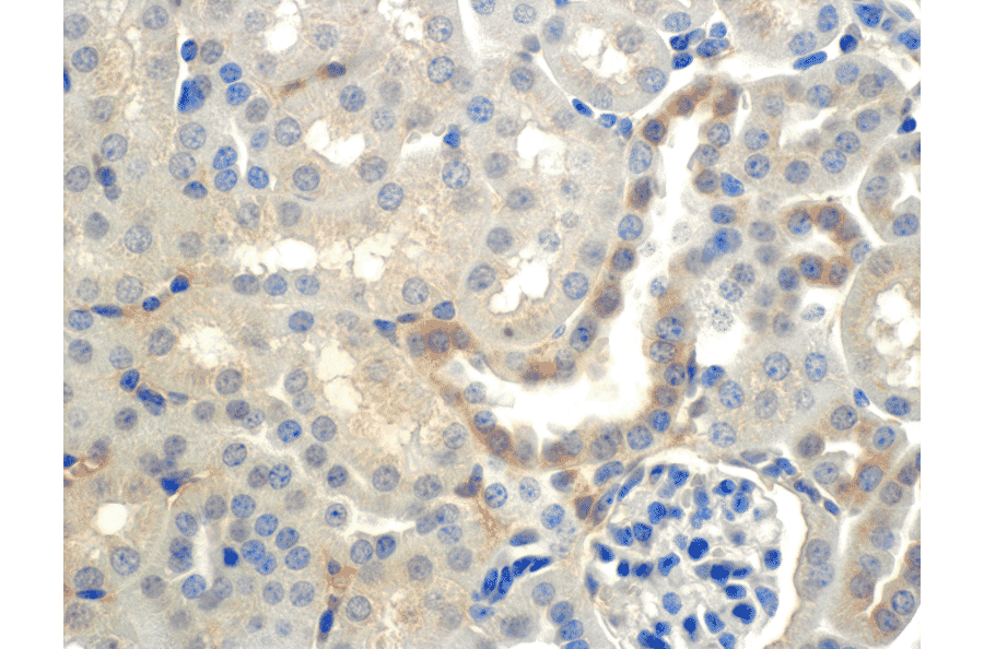 Immunohistochemistry - Anti-SCNN1B Antibody [7B8] (A305180) - Antibodies.com