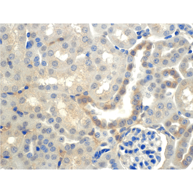 Immunohistochemistry - Anti-SCNN1B Antibody [7B8] (A305180) - Antibodies.com