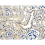 Immunohistochemistry - Anti-SCNN1B Antibody [7B8] (A305180) - Antibodies.com