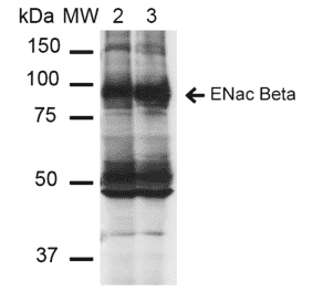 Western Blot - Anti-SCNN1B Antibody [16E4] (A305181) - Antibodies.com