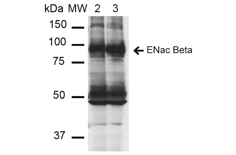 Western Blot - Anti-SCNN1B Antibody [16E4] (A305181) - Antibodies.com