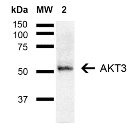 Western Blot - Anti-AKT3 Antibody (A305183) - Antibodies.com