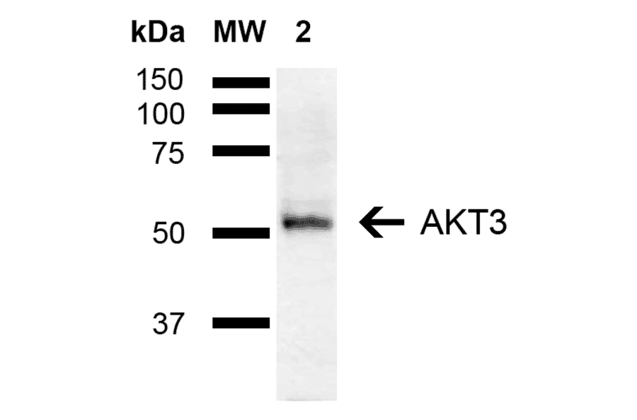 Western Blot - Anti-AKT3 Antibody (A305183) - Antibodies.com