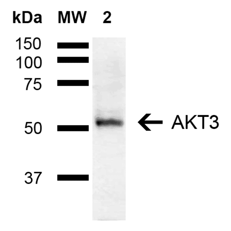 Western Blot - Anti-AKT3 Antibody (A305183) - Antibodies.com